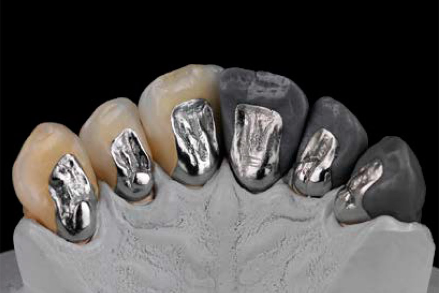 Z Crown Dental Ceramill® Sintron Image