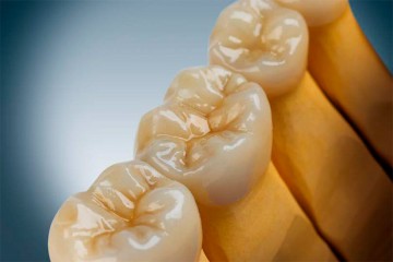 Layered Zirconia Ceramil®