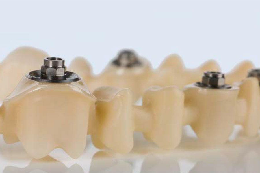 Z Crown Dental Layered Zirconia Ceramil® Image